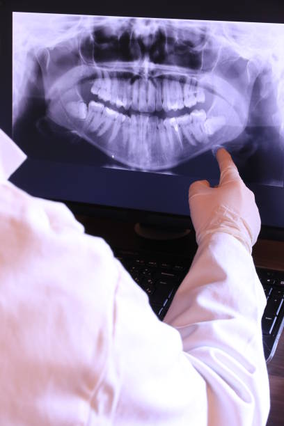 Best Emergency Gum Treatment in Sanibel, FL