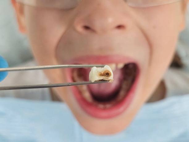 Best Pediatric Emergency Dentist in Sanibel, FL